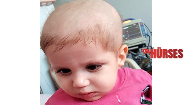 Ela Nur’a AÜ’de başarılı nakil