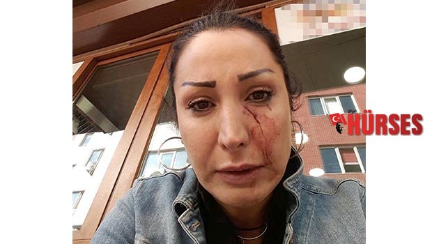 Garson bıçağı yüzüne fırlattı