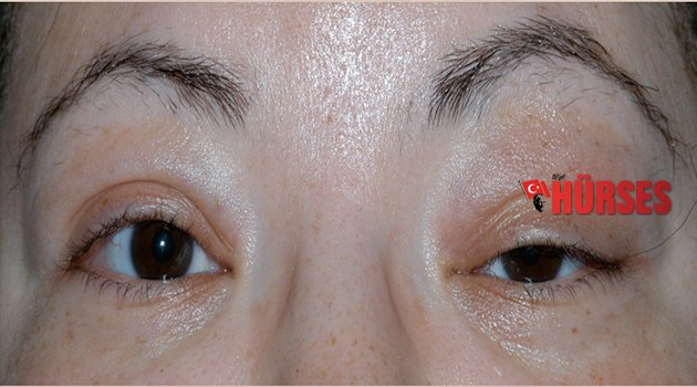 GÖZÜNÜZE GÖZÜNÜZ GİBİ BAKIN