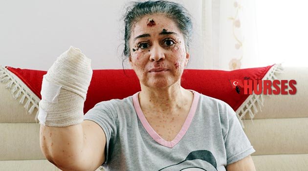 Güneşin erittiği kadın