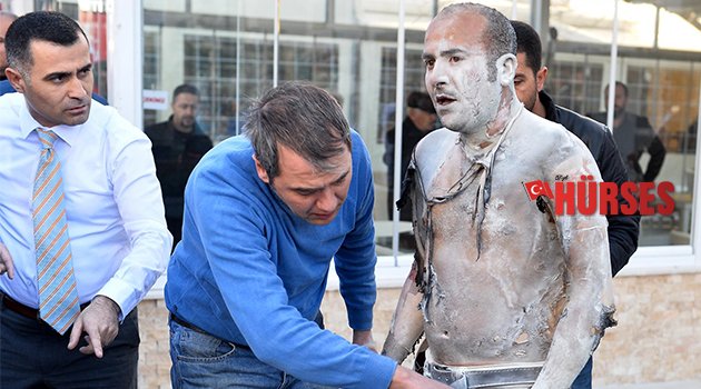 KENDİNİ YAKAN ADAM ÖLDÜ