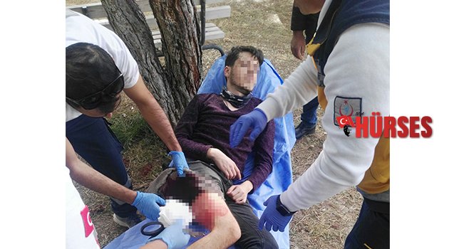 Kız kavgası kanlı bitti