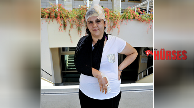 Kol kırıp baş yaran eşe 8 yıl 9 ay hapis