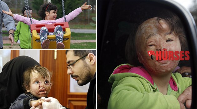Savaşın yaralarını Antalya’da sardılar