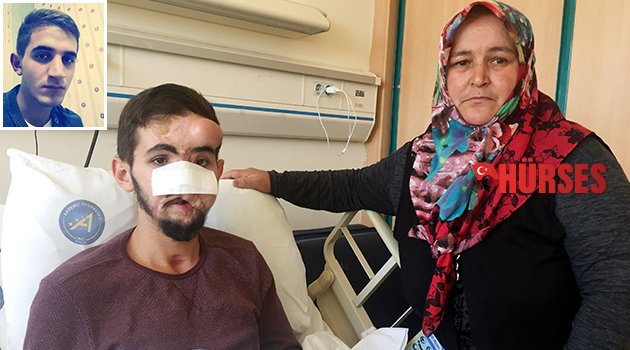 Üç yıl içinde 37’nci ameliyat