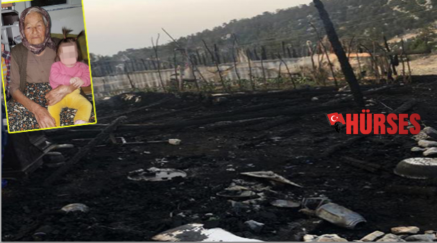Yanarak hayatını kaybetti