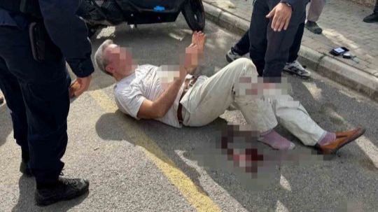 Alanya’da boşanma aşamasındaki eşini sokakta yaraladı