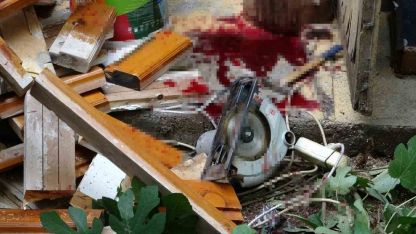 Bacağını elektrikli testereye kaptıran yaşlı adam ağır yaralandı
