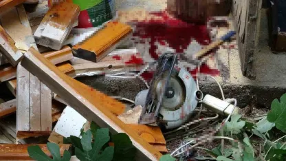 Bacağını elektrikli testereye kaptıran yaşlı adam ağır yaralandı