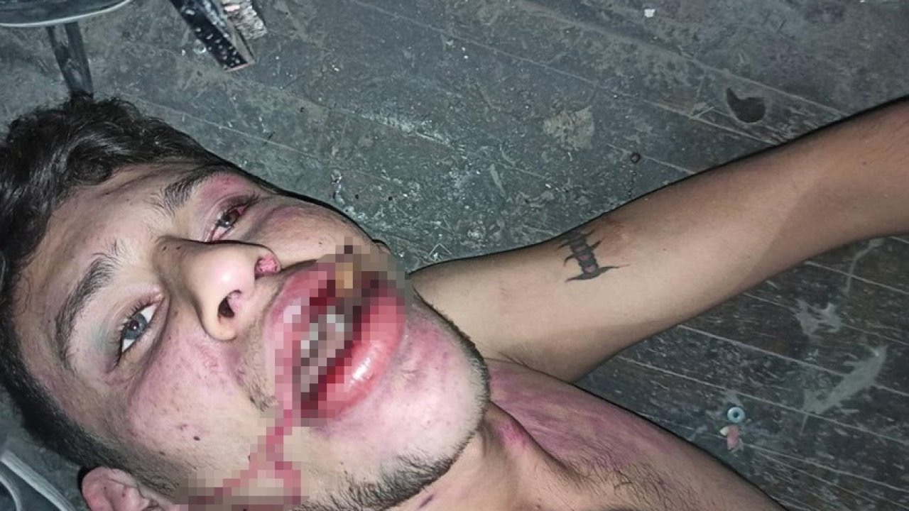 Hamam böceği yedirilen gencin dosyasında karar: Yağmadan beraat, hürriyeti tehditten 6 yıl 12 ay ceza