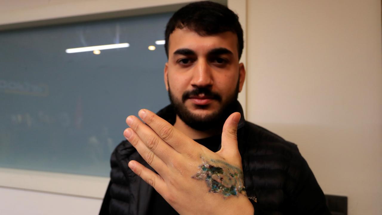 Kurtulmak isterken kabusu yaşadı