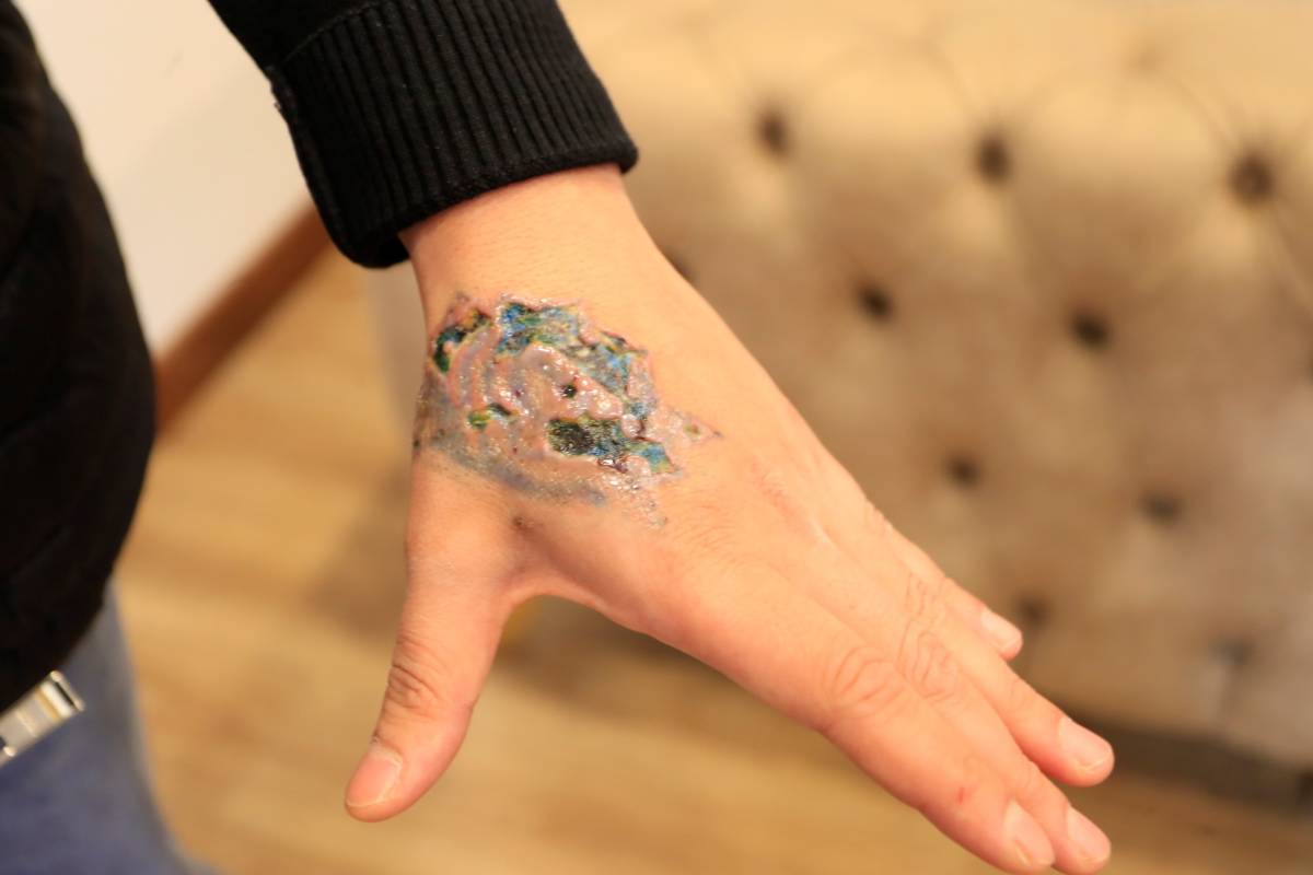 Kurtulmak isterken kabusu yaşadı